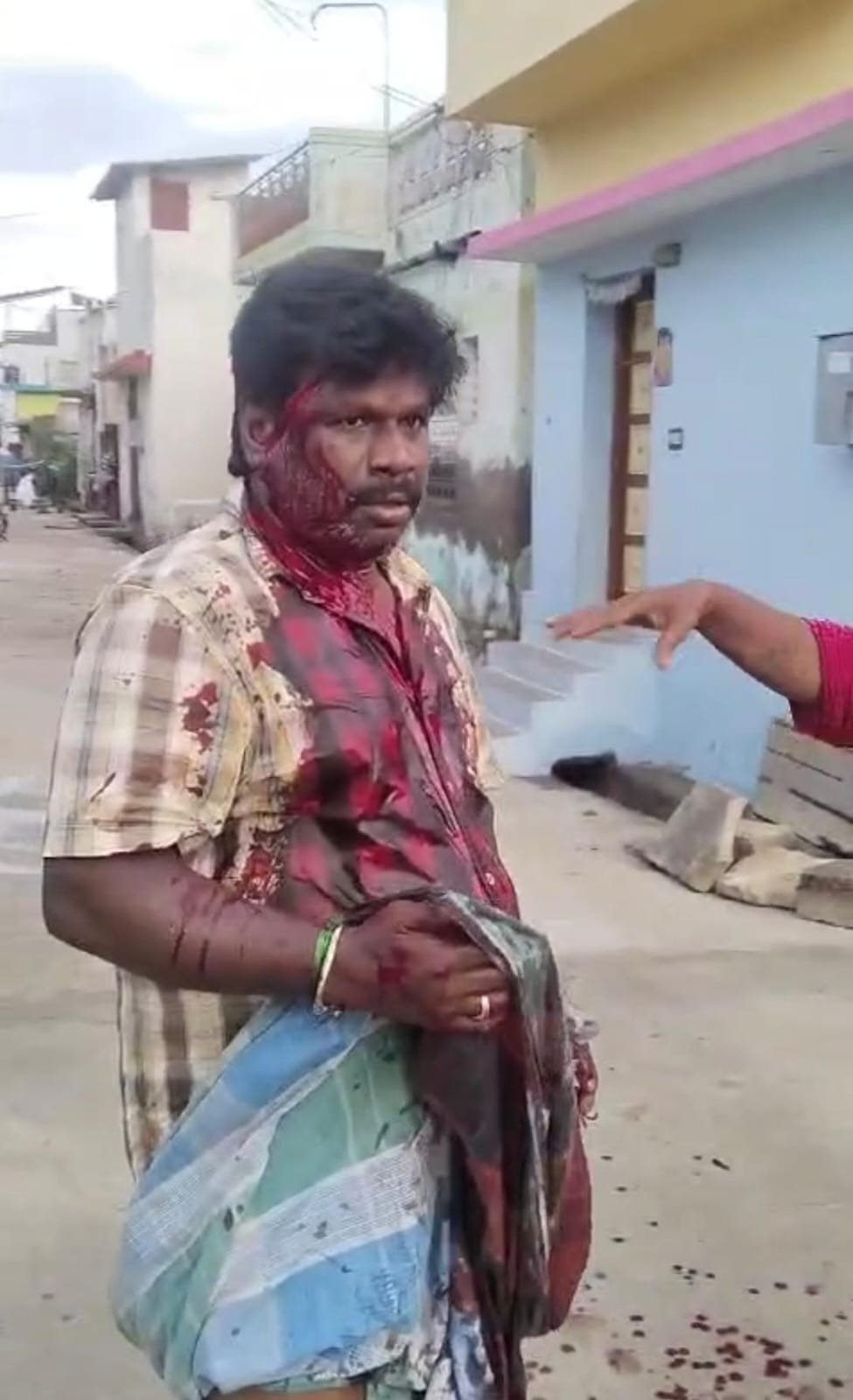 திருச்சி….பால் வியாபாரிக்கு சரமாரி வெட்டு….. 2 பேருக்கு வலை