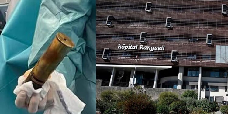 பிரான்ஸில் விபரீதம்: ஆசனவாயில் பீரங்கி குண்டுடன் வந்த இளைஞர் – மருத்துவமனை காலி