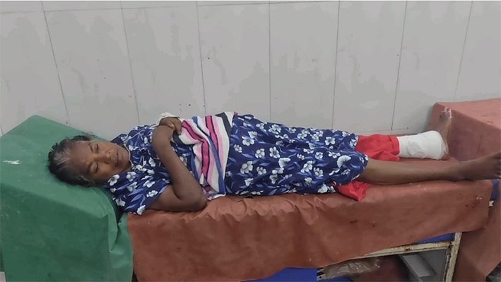 மூதாட்டியின் கால் கட்டை விரலை கடித்த எலி-திருச்சி ஜிஎச்-ல் ஷாக்