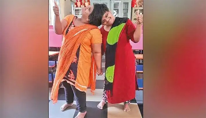 ஒட்டிப்பிறந்த இரட்டையர்களுக்கு தனித்தனி தேர்வறை? வினோதம்!