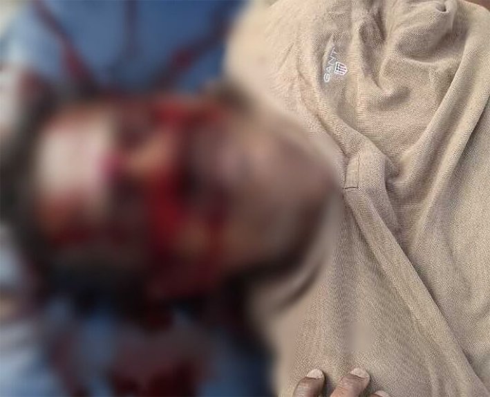 திருச்சியில் கார் மோதி தலை நசுங்கி தொழிலாளி பலி