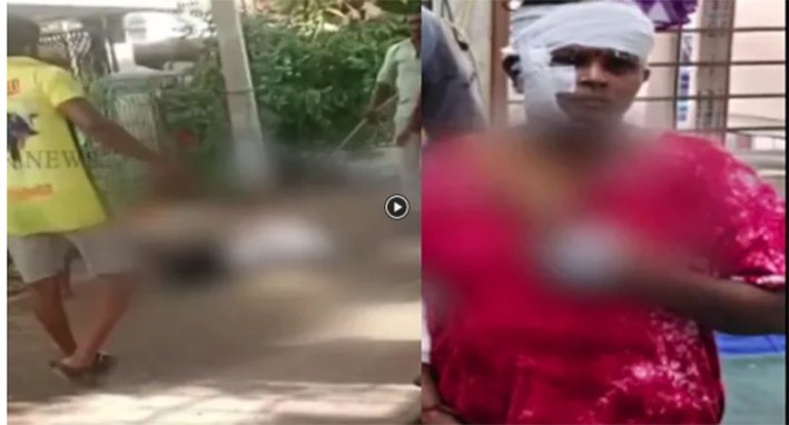 நாமக்கல் அருகே பிட்புல் நாய் கடித்து பெண் படுகாயம்